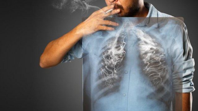 ilustrasi-paru-paru-perokok