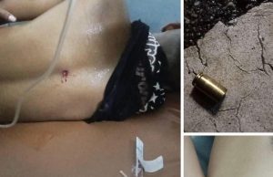 Joven 1 Hetan Tiru Hosi Membru Intelijénsia no Halo Agresaun Hasoru Ema ho Defisiénsia nain 1 Iha Tilomar